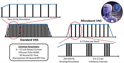 Modulation of the thalamus by microburst vagus nerve stimulation: a feasibility study protocol